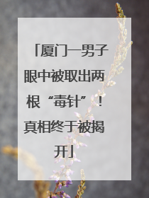 厦门一男子眼中被取出两根“毒针”！真相终于被揭开